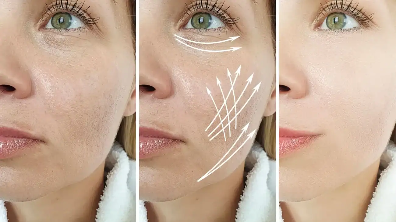 Can One Treatment Really Tackle More Than One Skin Concern Northampton?