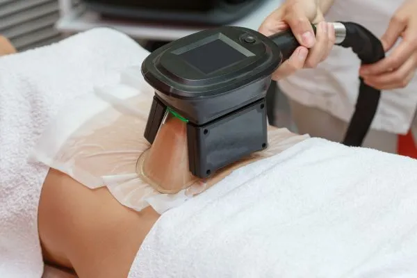 Image of person having fat freezing treatment to help weight gain Northampton