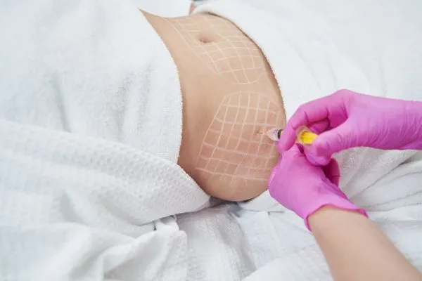 image of fat dissolving injections on love handles to help combat weight gain Northampton