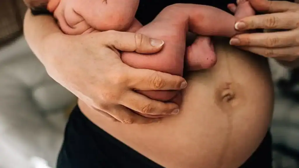 Why Is My Stomach Still Big After Pregnancy Northampton?